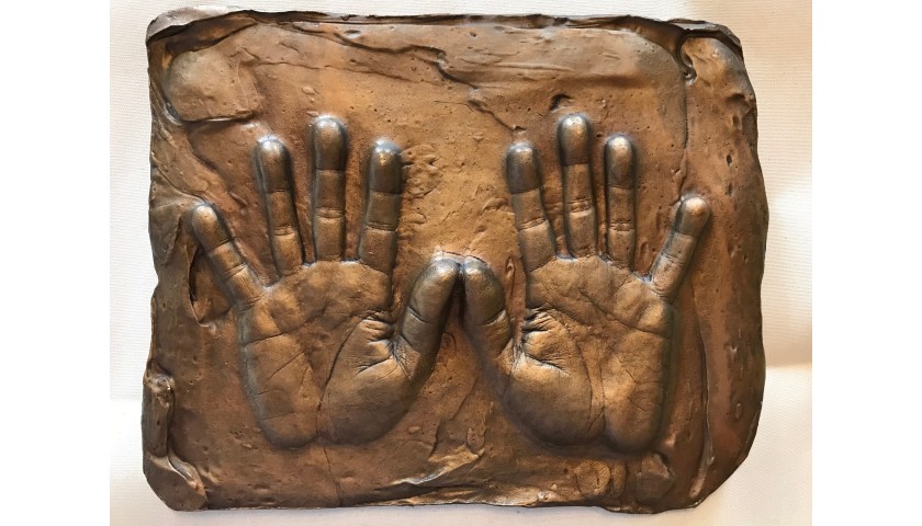 "Hands of Akon" by Glenn Bracke